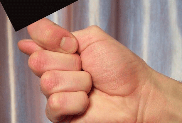 Simbolos De Protecao